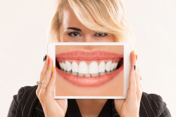 fluorose-dentaire-definition-et-symptomes-dentiste-conflans-ste-honorine