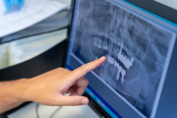 radiographie-numerique-dentaire-dentiste-conflans-ste-honorine
